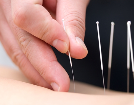 רפואה סינית